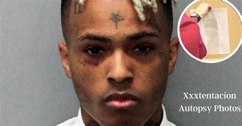 xxxtentacion death autopsy|Jahseh Onfroy (XXXTentacion) Autopsy Report